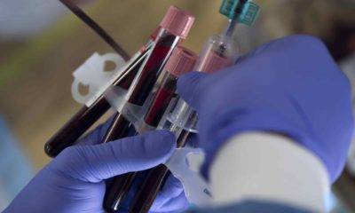 Bilim İnsanları Kan Grubunu Dönüştürebilen Bir Teknik Geliştirdi