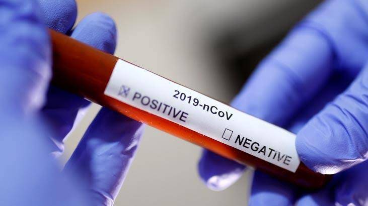 dünya sağlık örgütü koronavirüs acil durum pandemi nedir necmettin ünal